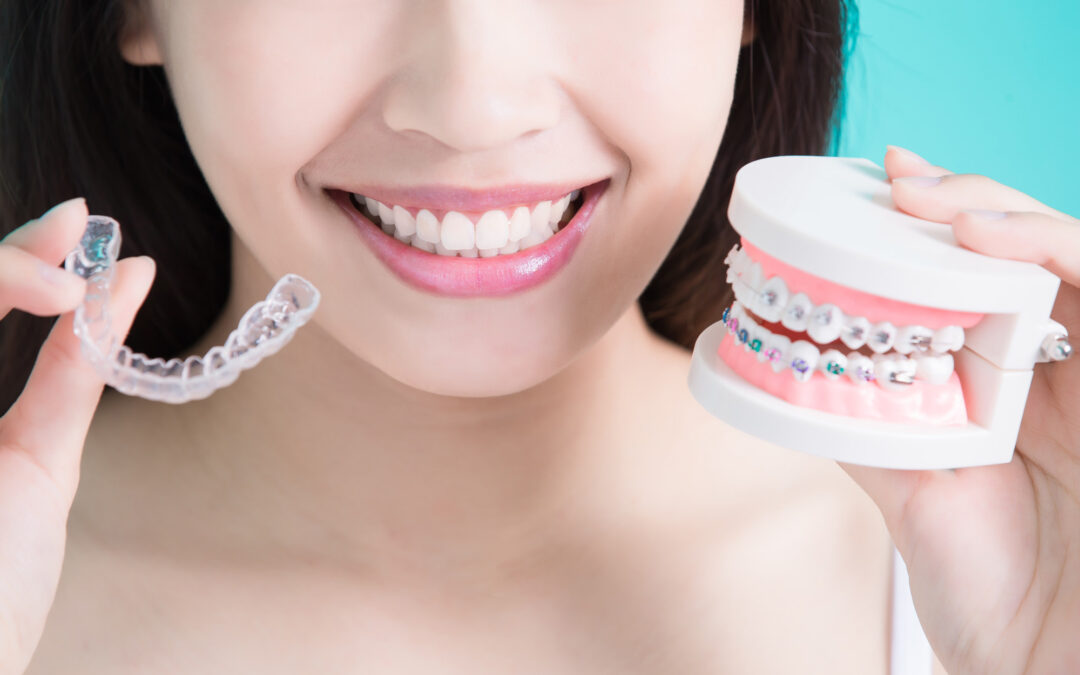 Invisalign Vs. Braces: Which One Is For Me?