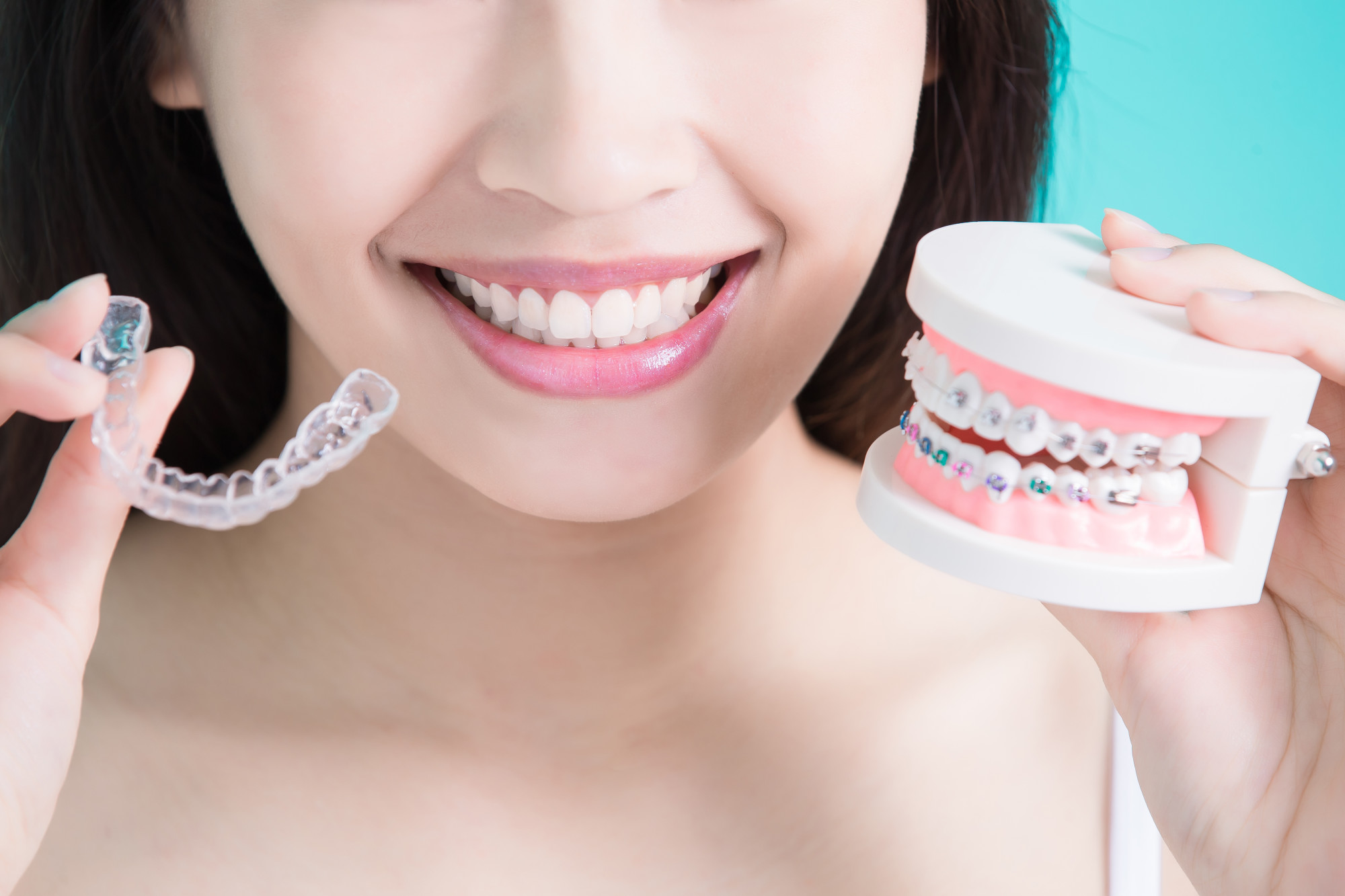 Invisalign Vs. Braces: Which One Is For Me