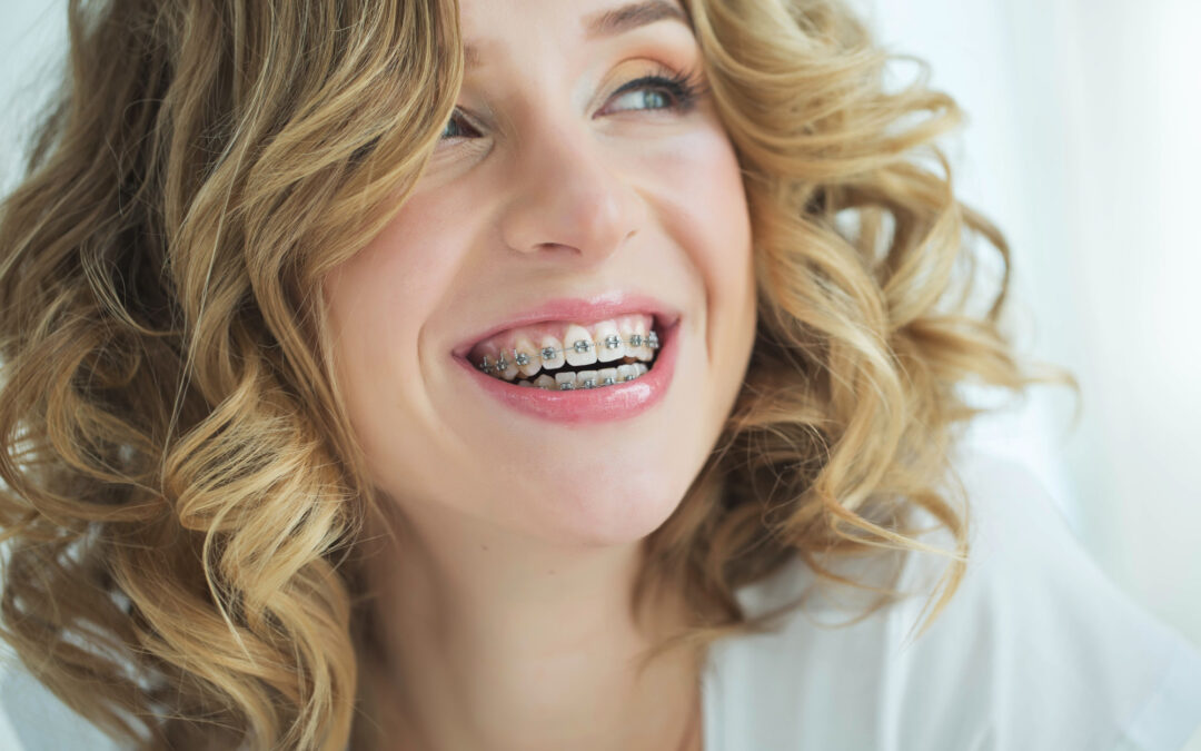 7 Factors To Consider When Choosing An Orthodontist