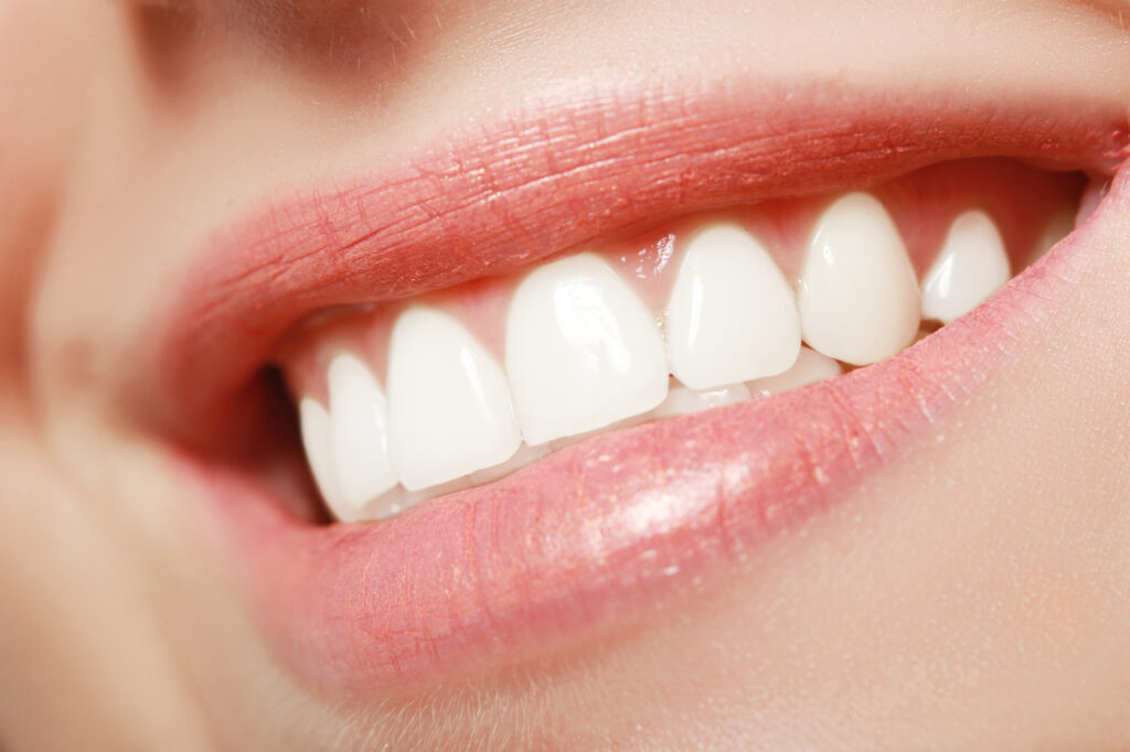 Braces fort mill sc