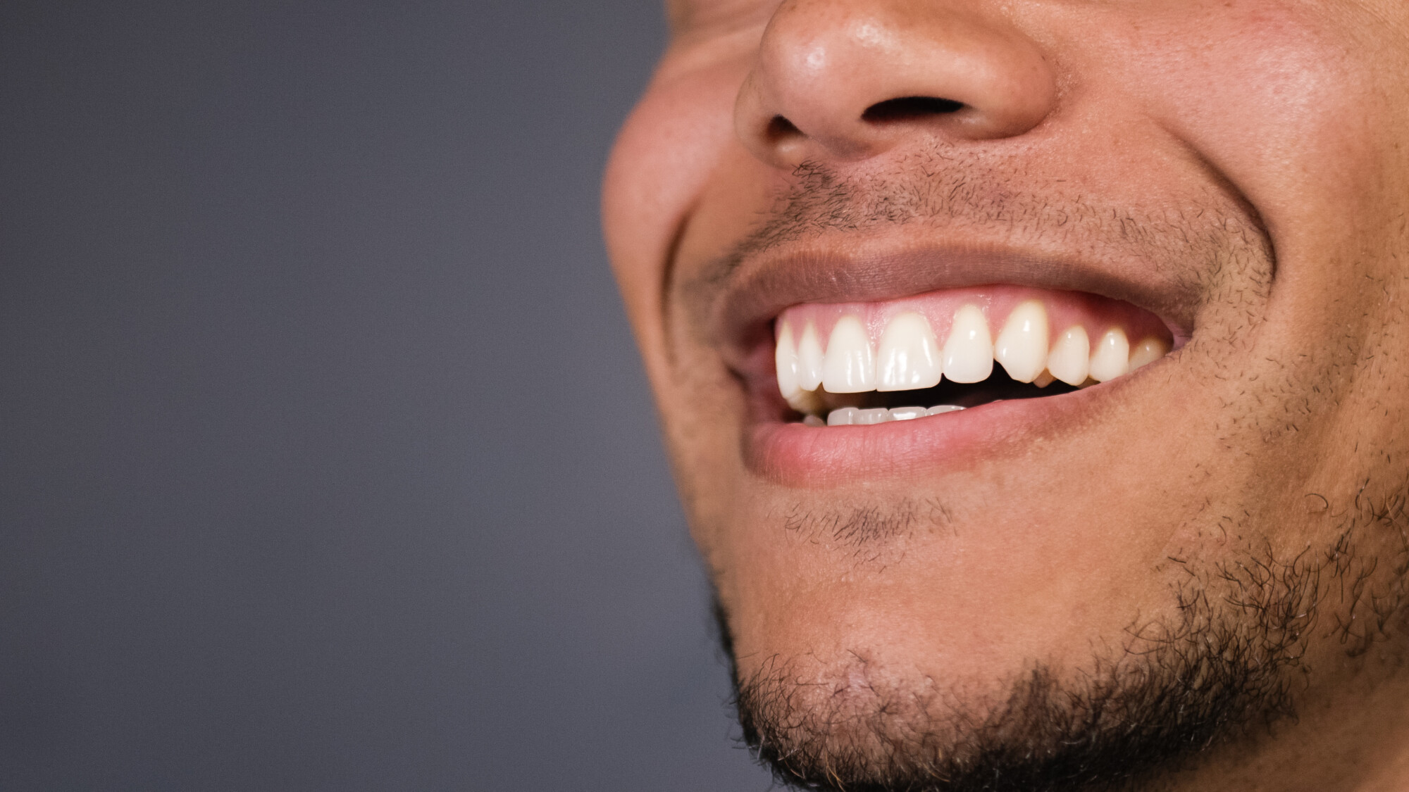 Invisalign teen in Indian land sc