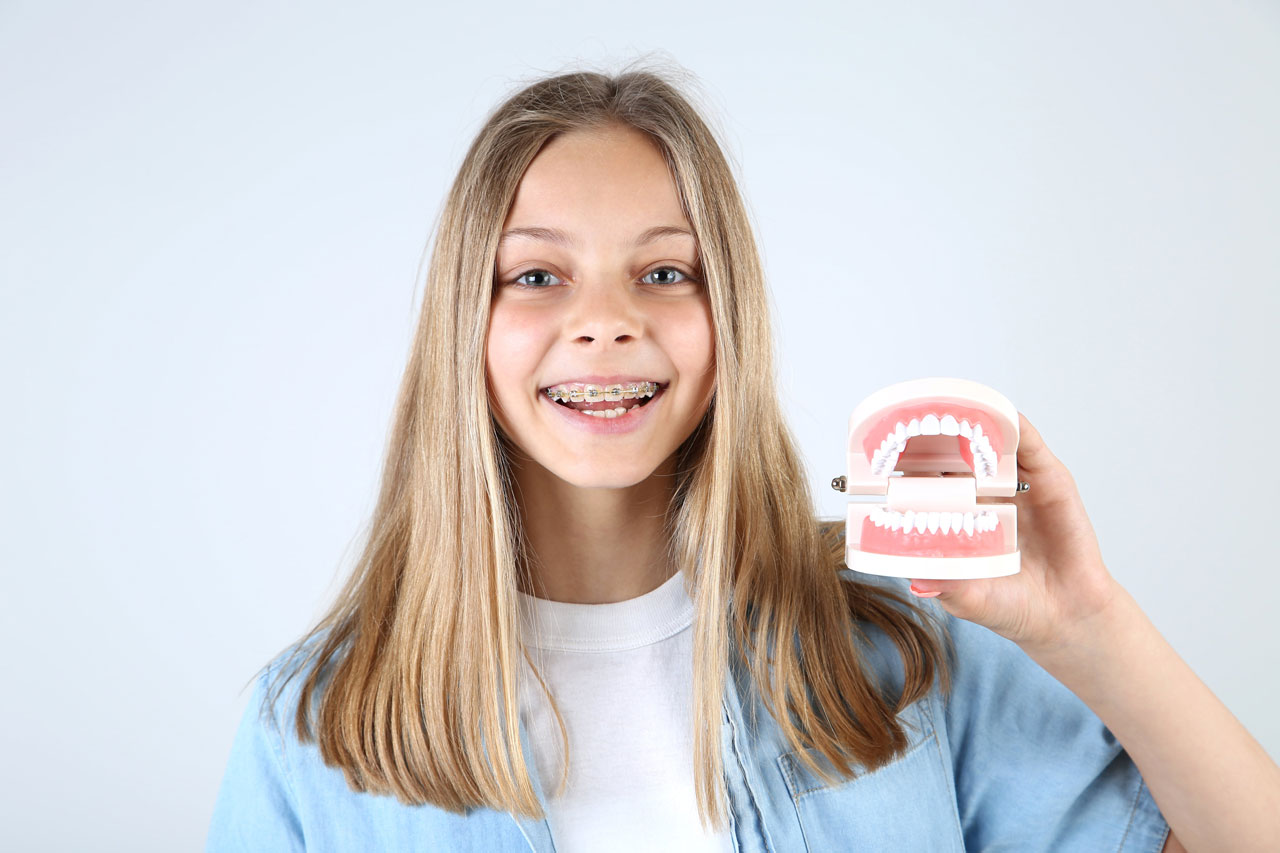 traditional-braces-1