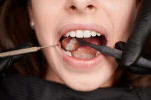 orthodontist Waxhaw SC